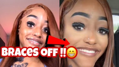 Getting My Braces Off Vlog ( After 2 years)