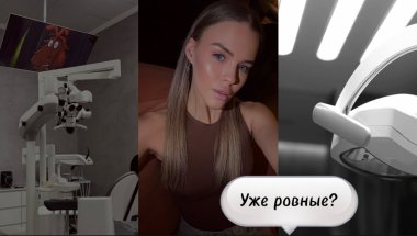 2 МЕСЯЦА С БРЕКЕТАМИ