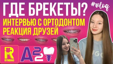 ВСЯ ПРАВДА О БРЕКЕТАХ | Мой путь с брекетами | Частые вопросы #варярындина #ryndinschannel #брекеты