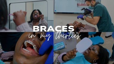 Getting Braces...Again In My 30's | Honest Review + Tips
