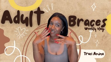 ADULT BRACES VLOG! Braces in your 30s | What no one talks about + MORE