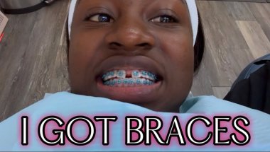 CLOSING MY GAP | GETTING BRACES | VLOG