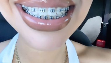 Braceface cutie