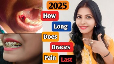 How Long Does Braces Pain Last || How To Get Rid Of Braces Pain Fast || Nd Family Vlogs #braces