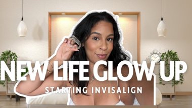 how to Glow Up | start Invisalign week 1 + update