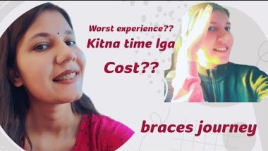 My braces journey. worst desicion??#braces