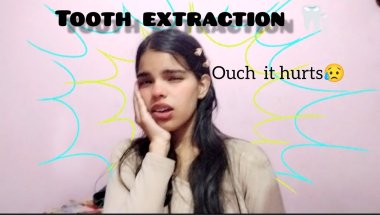 "TOOTH EXTRACTION EXPERIENCE WITH BRACES "🦷🔧| watch till end