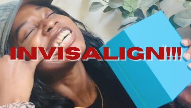 I Got Invisalign!!! | My Actual Take On Them