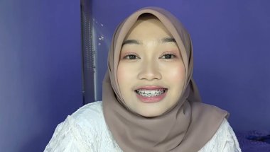 kontrol behel ke-28 | bingung pilih retainer