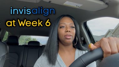 Invisalign Week 6 Dental Appointment