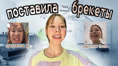 ПОСТАВИЛА БРЕКЕТЫ🦷// история установки