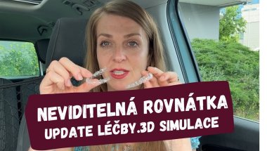 Neviditelná rovnátka 8.díl - update léčby, 3D simulace