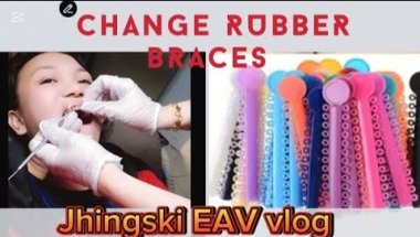 MAG PAPA ADJUST  AT PAPALIT NG RUBBER NG BRACES  #OFWCAREGIVEROMAN  [CHANGE RUBBER BRACES]