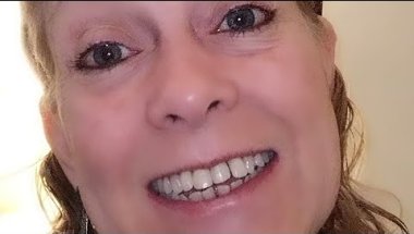 Do It Yourself Braces