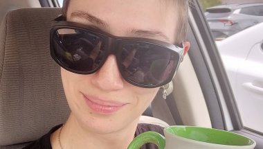 20 Month #adultbraces update!