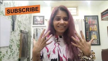 Braces journey #braces#extraction#transformingsmile #clearbraces#damonbraces