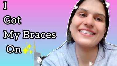 I got My Braces On || My experience ||Upbeat Shivamira||