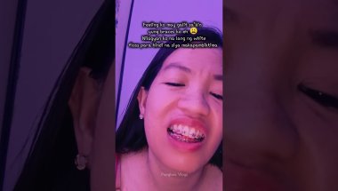 BRACES LIFE, GUMS KO NAGSUGAT