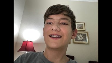 Getting My Braces