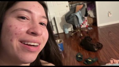 My experience with Invisalign