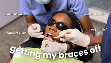 FINALLY GETTING MY BRACES OFF!! | my experience, braces cost, retainers & more!