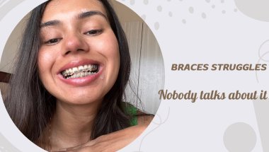 Nobody Talks About THIS with Braces | Real Talk 💬💙 #bracesjourney
