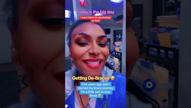 #braces #bracesoff #bracestransformation #bracesbeforeandafter #watchtillend #contentcreator #tiktok