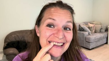 I got Invisalign..and what I wish I would have known beforehand!
