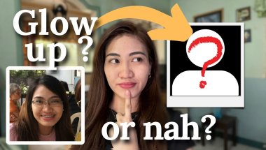 Braces Before & After | Flared Teeth to Straight Smile | Braces Transformation