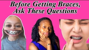 10 Questions You MUST Your Orthodontist During Your Braces Consultation