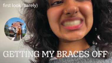 GETTING MY BRACES OFF after 4 YEARS + retainer and reactions
