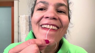 SAGA DO APARELHO DENTÁRIO PARTE 2 - UMA SEMANA DE TRATAMENTO