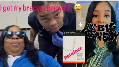 After 3 1/2 years I FINALLY GOT MY BRACES REMOVED!!! The BIG Reveal 😬 | I got my retainer 🦷