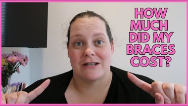 How much did my braces cost? + 1 Week Update!