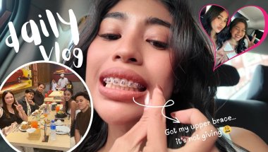 Getting My Upper Braces + Life Lately Vlog 🦷✨