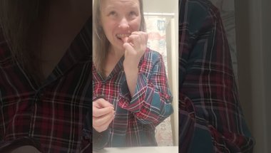 Invisalign update
