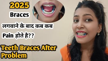 Adult Braces | 2025 Braces लगवाने के बाद कब कब Pain  होता है?? | Teeth Braces After Problem