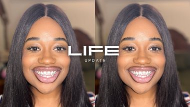 Life Update 2025 | I Got Braces, New Projects, Camera Equipment, ETC
