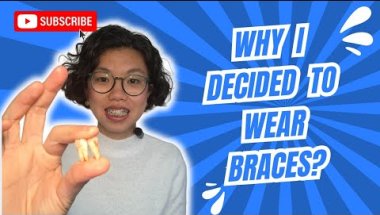 Why I decided to wear braces?