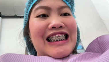 LAST BRACES ADJUSTMENT on June 14 2025 #thankful #braces