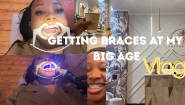 My Braces Journey Begins | Before & After Vlog