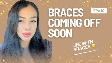 Braces coming off soon #braces #selfgrowth #bracesoff #braceslife