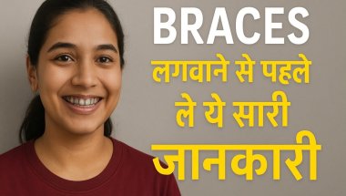 Part -2 ब्रेसिज़ लगाने से पहले पूरी जानकारी लें |  #orthodontics #braces #bracestreatment
