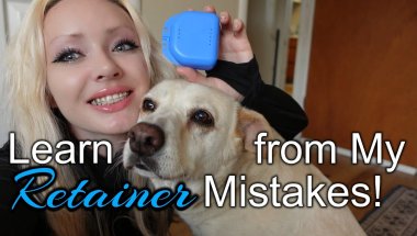 Retainers: Things I wish I'd known // AFTER BRACES