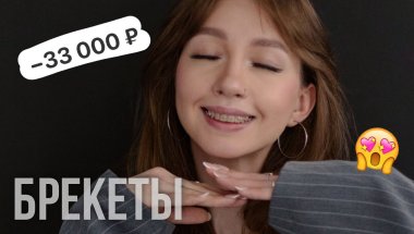 Я поставила брекеты!