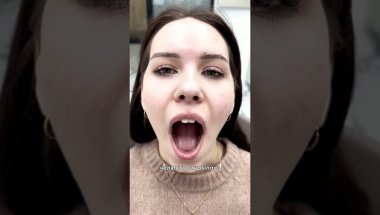 Сплинт может помочь при головной боли🔥