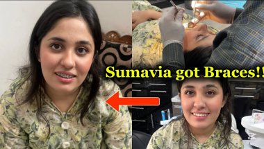 Sumavia got braces !!!! Explained the entire dental procedure| All 10 cousins fit in my small car 😂🚗