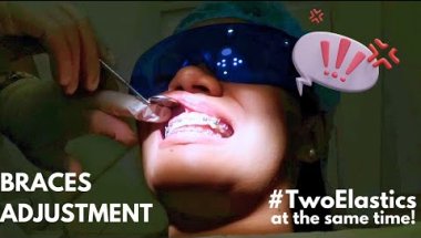 #BracesUpdate🦷: A VLOG FILLED WITH MY DENTIST'S ADVICE AND TRIVIAS