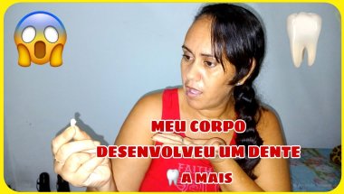 Meu corpo desenvolveu um dente a mais em minha Boca /👄/#viralvideo #dentista #aparelhoortodôntico