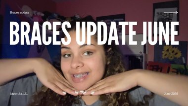 Braces update June Month 1